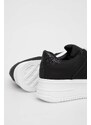 Answear Lab sneakers culoarea negru